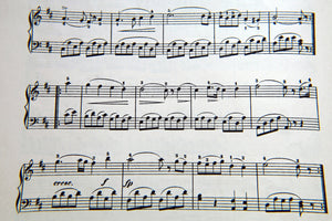 3-piece-acrylic-print-music-notes